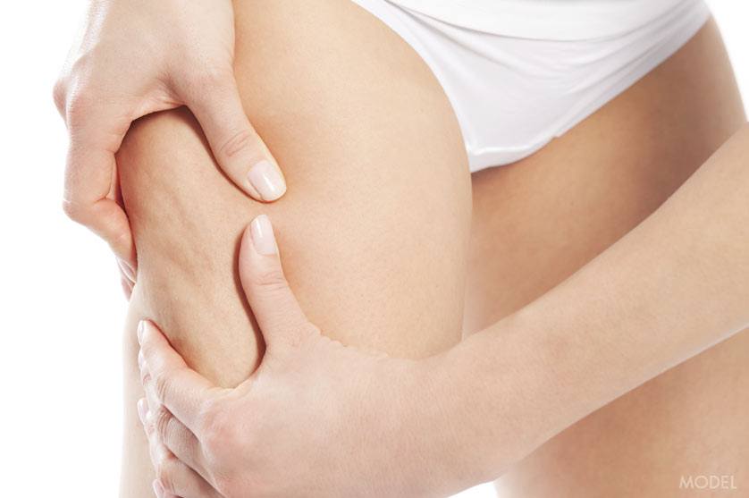 Thigh Lift (Thighplasty) thumbnail 4