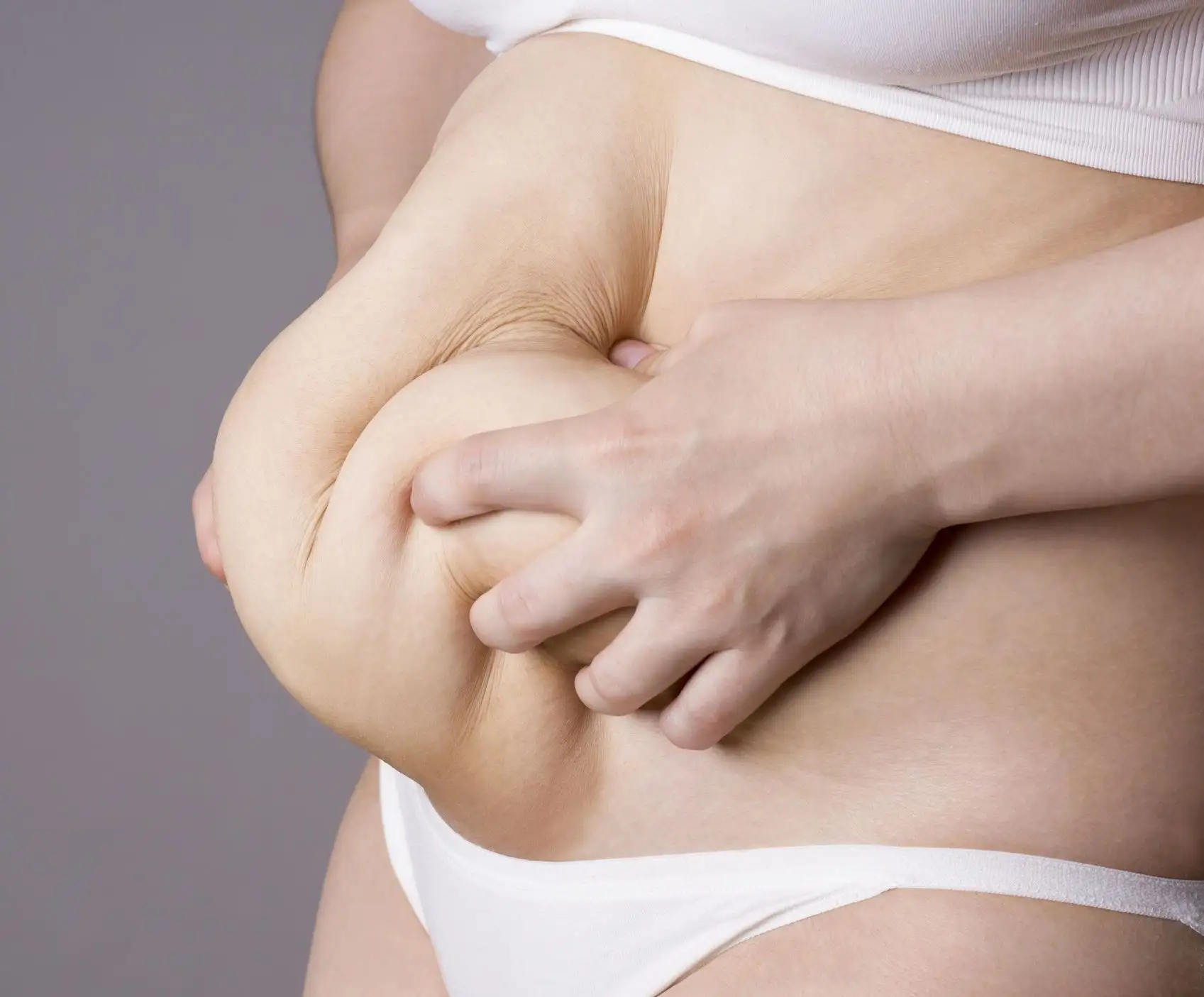 Body Lift (Belt Lipectomy) - Image 2 of 5