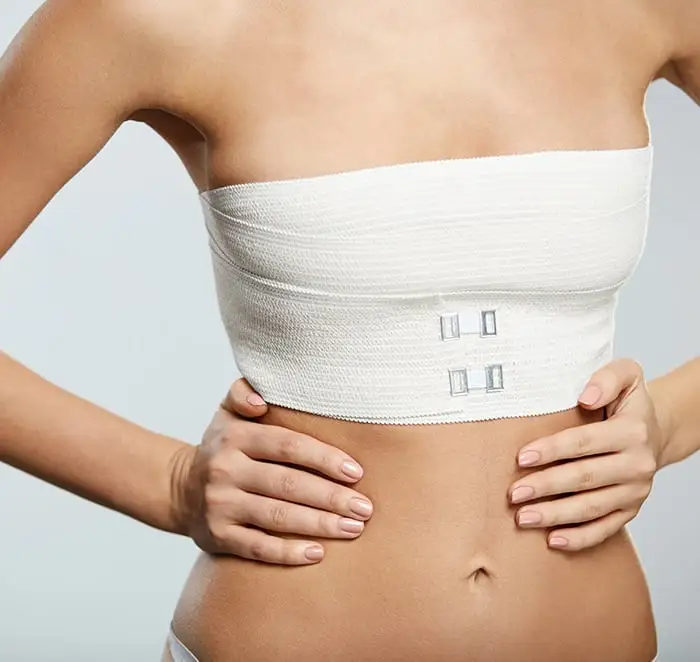 Breast Reduction (Reduction Mammoplasty) - Image 2 of 4
