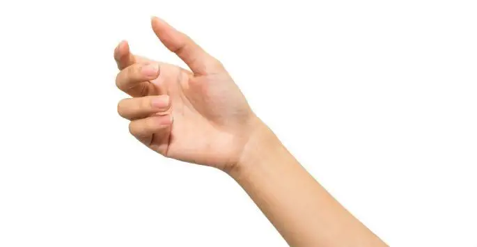 Dupuytren's Contracture (Fasciectomy) - Image 2 of 3
