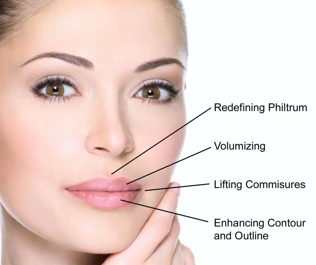 Lip Fillers (Dermal Filler Injections) - Image 2 of 4