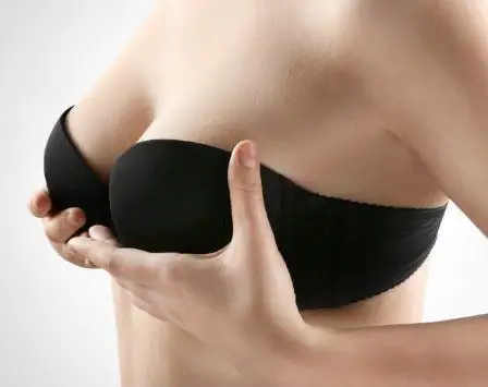 Breast Lift (Mastopexy) - Image 3 of 4