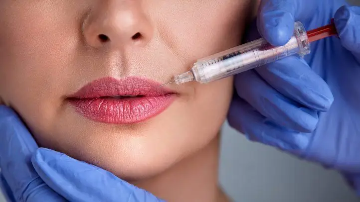 Lip Fillers (Dermal Filler Injections) - Image 3 of 4