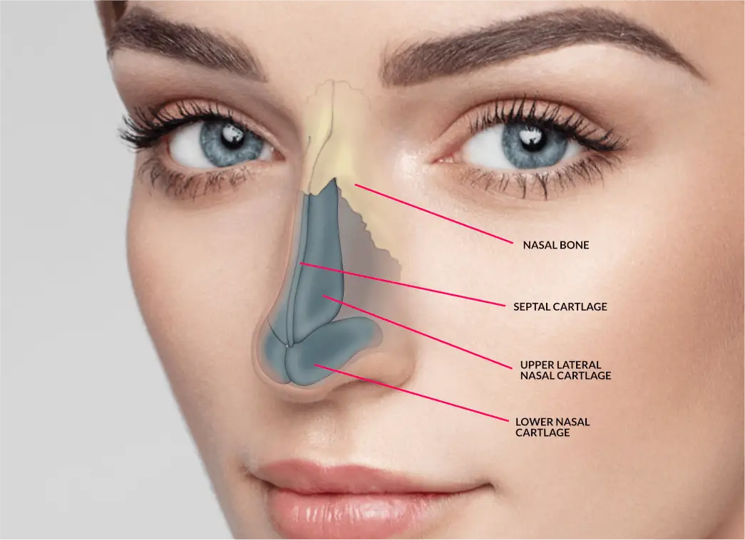 Nose Job (Rhinoplasty) - Image 3 of 4