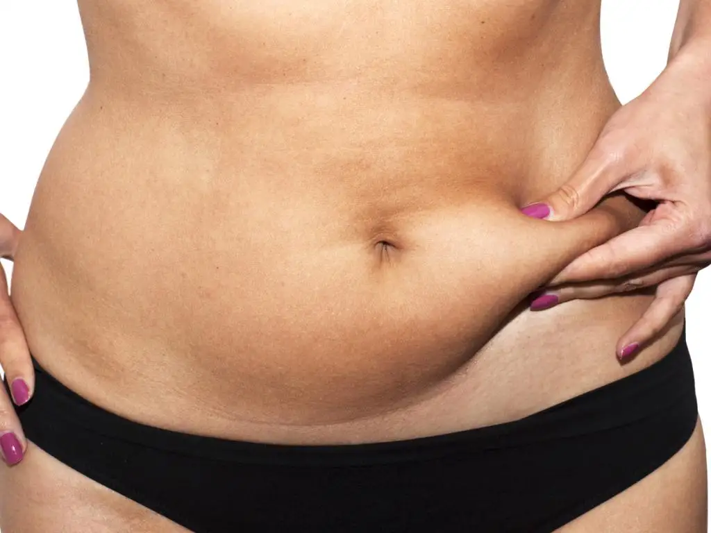 Tummy Tuck (Abdominoplasty) - Image 3 of 6