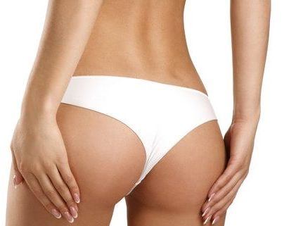 Body Lift (Belt Lipectomy) thumbnail 5