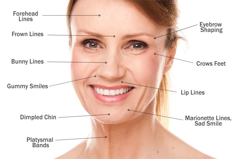 Facial Fillers (Dermal Filler Injections) thumbnail 3