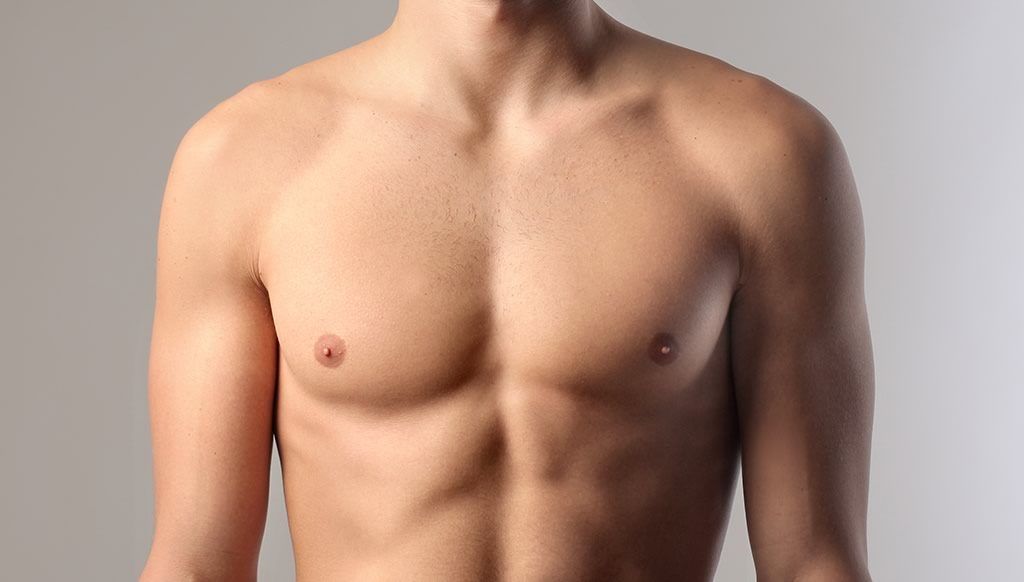 Male Breast Reduction (Gynecomastia Surgery) thumbnail 1