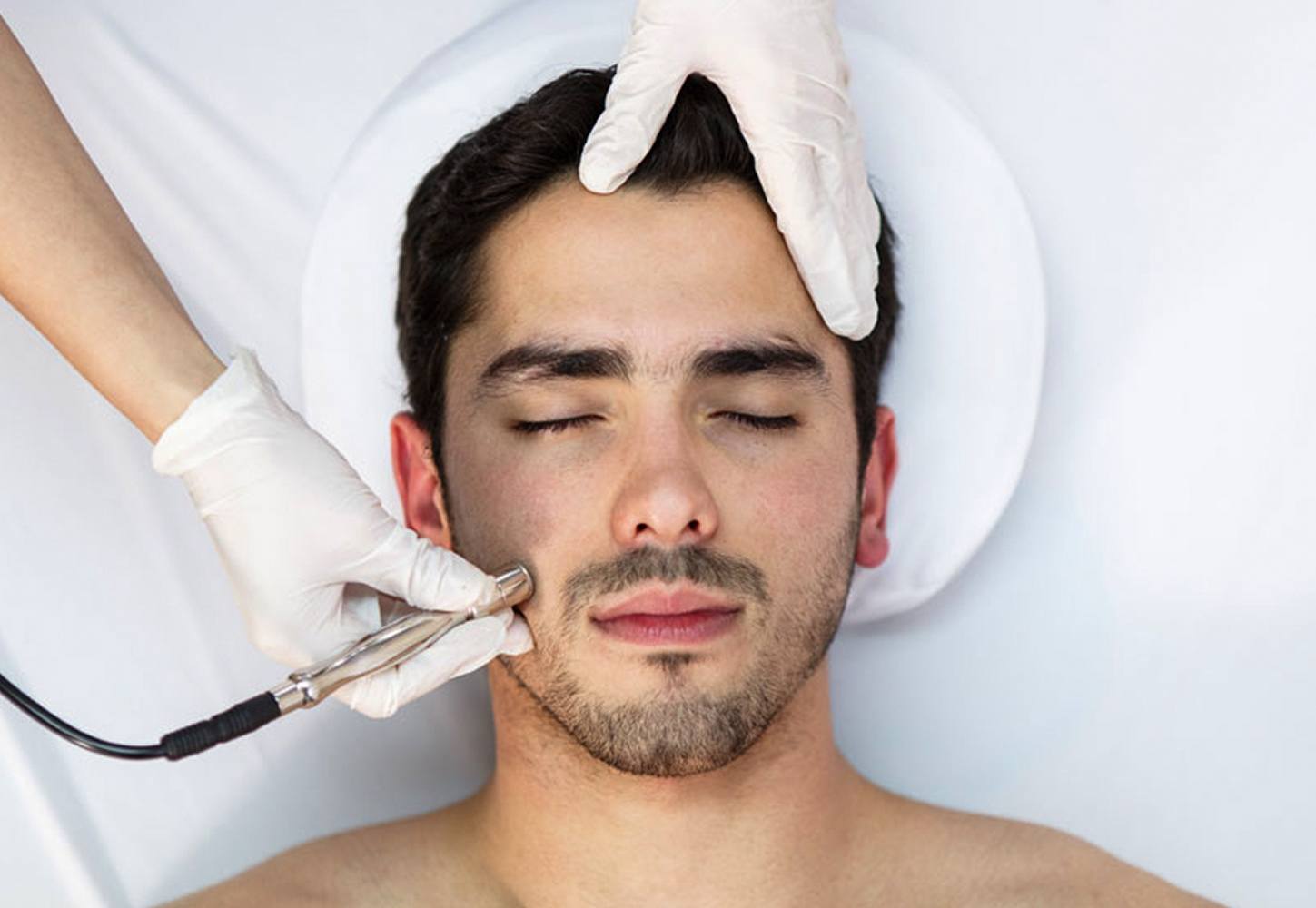 Microdermabrasion (Mechanical Exfoliation) thumbnail 2