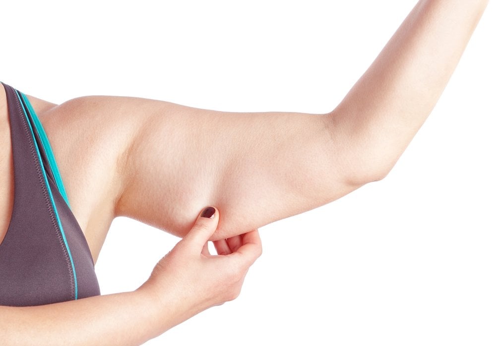 Arm Lift (Brachioplasty)