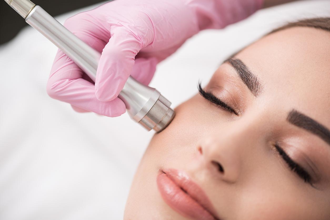 Microdermabrasion (Mechanical Exfoliation) - Image 1