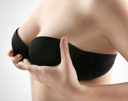 Breast Lift (Mastopexy) - Image 3 of 4